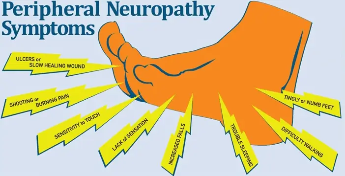 peripheral neuropathy on feet | Active Health | Fort Myers, FL